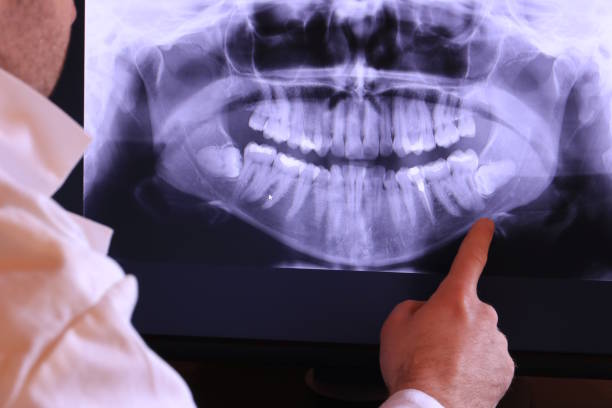 Best Emergency Root Canal Therapy in Woxall, PA