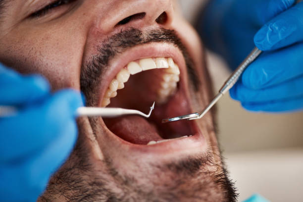 Best Broken or Chipped Tooth Repair in Woxall, PA