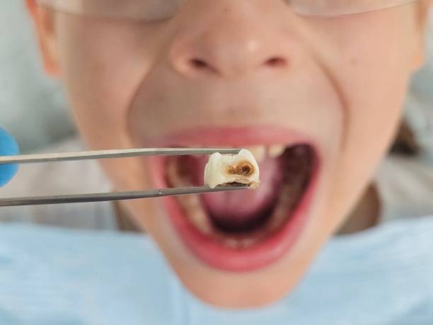 Best Weekend Emergency Dental Services in Woxall, PA